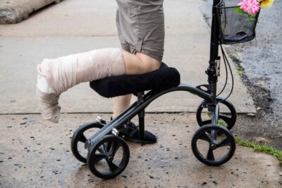 A person with a bandaged foot and calf using a knee scooter.
