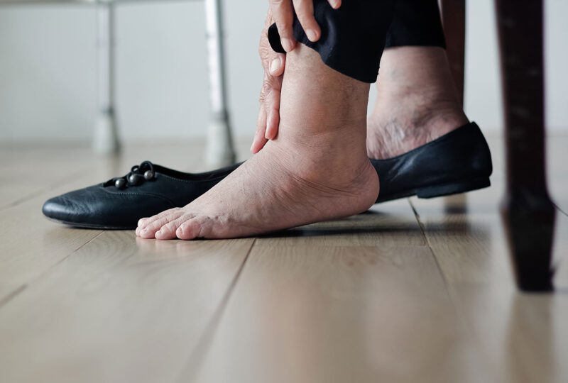 What home exercises help with swollen ankles in seniors?