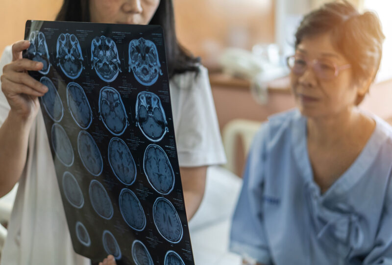 patient looking at brain scans in medical office